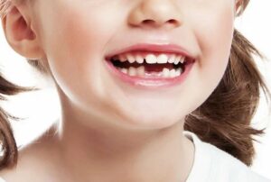 Нужно ли удалять молочные зубы  у детей?