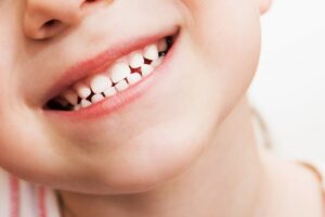Как безболезненно удалить молочный зуб: практическая информация