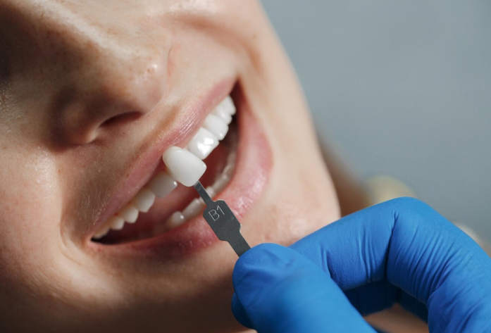 Совершенство в деталях: современные коронки для передних зубов